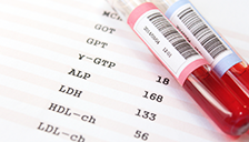 婦人科がん検診